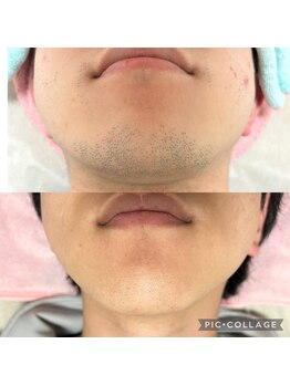 ミーフォレスト(Mi Forest)/