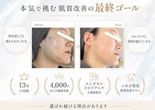 オジ(oJi)