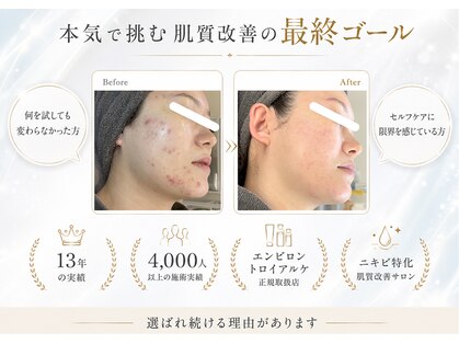 オジ(oJi)の写真
