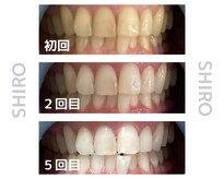 シロ 湘南台店(SHIRO)