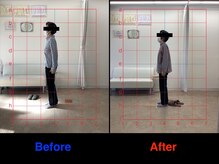 整体院 仁(JIN)/#ストレートネック#猫背#骨盤