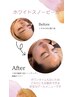 【ハリツヤ◎】理想の美肌を実現！ピーリングフェイシャルケア¥15000→¥8000