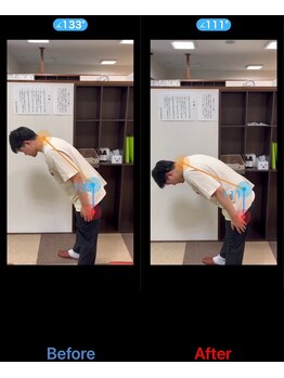 うらら整骨院/しっかり前屈出来ました！