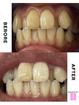 エクシアホワイトニング 王寺店/