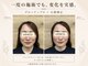ヴィーネス(VIENESS)の写真