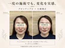 ヴィーネス(VIENESS)