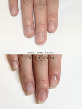 マリーロール 梅田店(Marie Laure)/自爪育成/深爪矯正/ネイルケア
