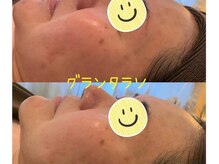 エステ ド あーと/before/after