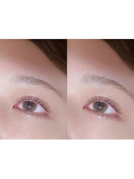まつげのお悩み解決サロン