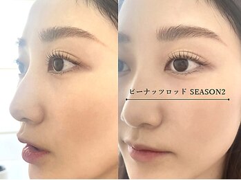 ミネアート 西日暮里店(MINEART)/NEW☆ピーナッツロッドSEASON2