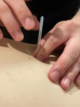 なりひら治療院の写真/肩こり、腰痛、頭痛、などの慢性的な痛みにお悩みの方に◎筋肉の緊張を和らげ、コリや疲労感を解消します！
