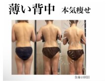 オーシャンブルーム 目黒(OceanBloom)/上半身痩せ