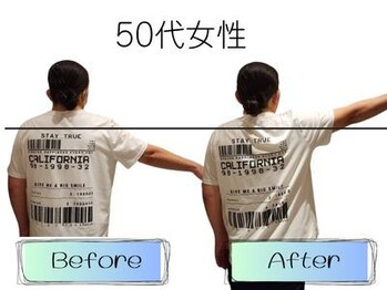 ビールーム 赤羽店(B-ROOM)/肩こりの悩み50代女性(右)