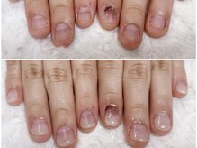 グラシナ 鳥丸店/バレない矯正