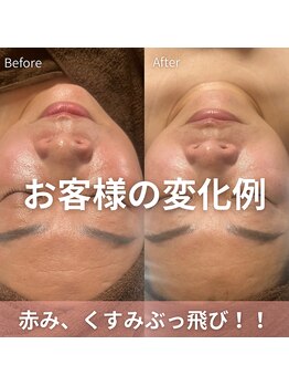 アイビーケア 三田(ivy care)/赤み、くすみ軽減!