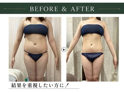 アディッシモ(addissimo)の写真