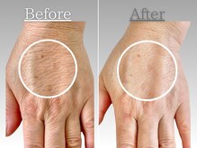 リジェネイルズ(Rege Nails)/美肌育成エステコース