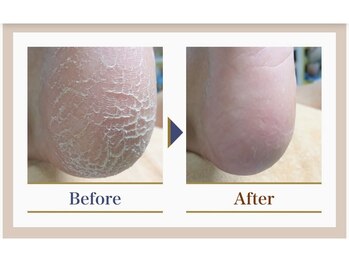 巻き爪補正店 錦糸町店/【トータルフットケア】