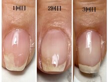 爪のコンプレックスを改善できるネイルサロン♪