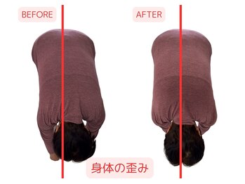 浜町しあわせ整体院/身体の歪み