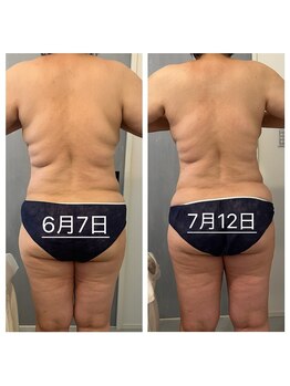 美温(mion)/結果にコミットからのリバウンド