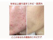 小顔コルギサロン シー(She)の雰囲気（エステ初めての方でも大歓迎★ブライダルやギフトにもオススメ♪）
