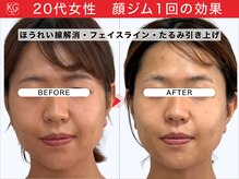 顔ジム 麻布店/20代女性顔ジム1回の効果