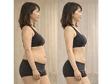 美座ノ女 梅田 淀屋橋本店/施術前後(横側)　整体→脂肪冷却