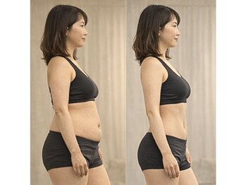 美座ノ女 梅田 淀屋橋本店/施術前後(横側)　整体→脂肪冷却