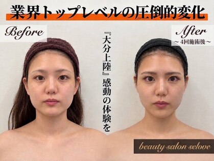 「小顔に本気。」都度払い小顔専門店beauty salon seloveの写真