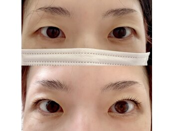 マドモア 飾磨店(MADEMORE)/【ダブルアイリフト】驚きの効果