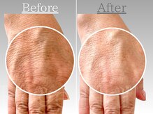 リジェネイルズ(Rege Nails)/美肌育成エステコース