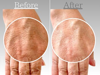 美肌育成エステコース