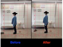 整体院 仁(JIN)/#手根管#痛い#手首#曲げられない