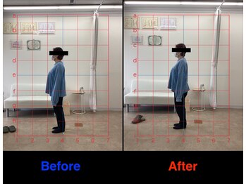 整体院 仁(JIN)/#手根管#痛い#手首#曲げられない