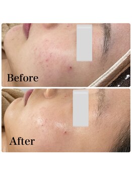 モスト(MOST)/エンビロンフルコース