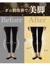 デップ 南森町店Espoir(DEP)/【大阪ピラティス】O脚・膝痛