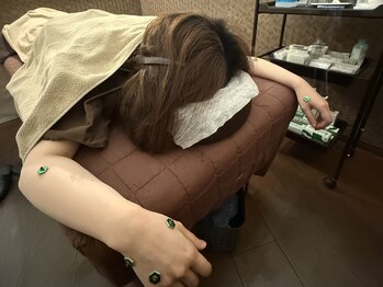 チャチャエイム整骨院 鍼灸院/【鍼灸】体の疲れやコリに!