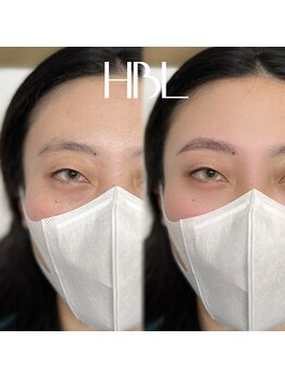 レアファースト/ハリウッドブロウリフト/眉毛