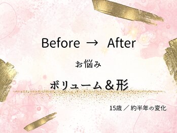 ロットプラス(Lot Plus)/Before→After【10代のお客様】