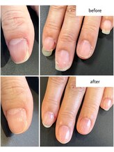 ケアプラス(care plus)/ハンドネイルケア