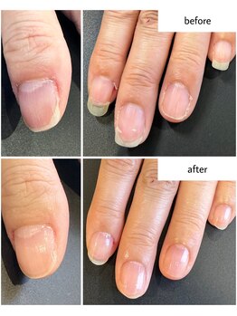 ケアプラス(care plus)/ハンドネイルケア