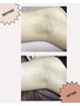 【学生専用ワキ脱毛】￥1,320（小学生）￥1,408（中学生）￥1,496（高校生）