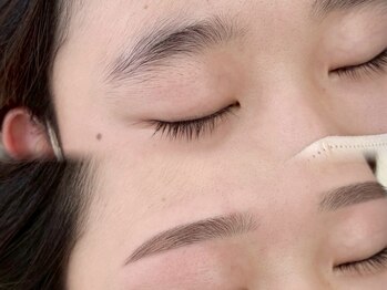 ホワイトアイ 心斎橋(WHITEEYE)/【眉毛/まゆげ】Before/After