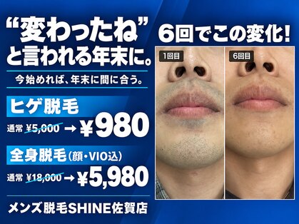 シャイン 佐賀店(SHINE)の写真