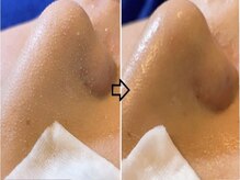 トータルビューティーサロン シフォン(Cfon)の雰囲気(お悩み何でもフェイシャルケア 5,500円)