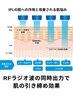 【皮膚のリフトアップ】IPL×ラジオ波 同時照射+ビタミンイオン導入