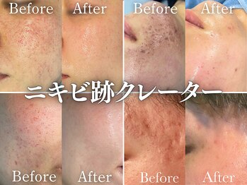 リメイク 銀座(REMAKE)