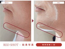 ミール(Meel)の雰囲気（小顔の効果絶大◎）