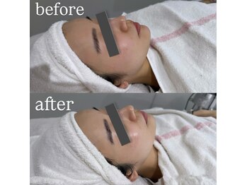 アールビューティー 東新宿店(R’Beauty)/クリスティーナ/アンストレス